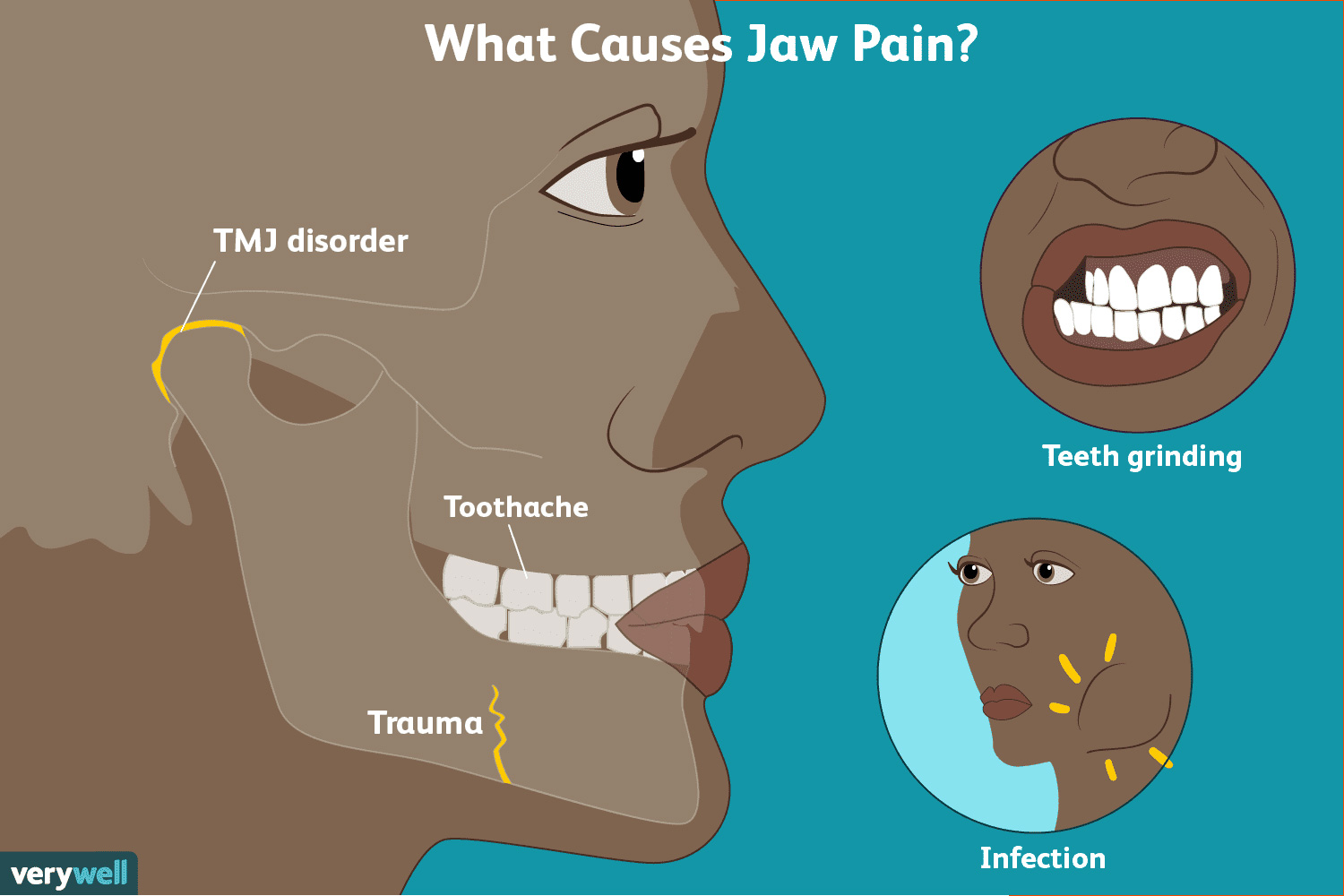 TMJ Treatments